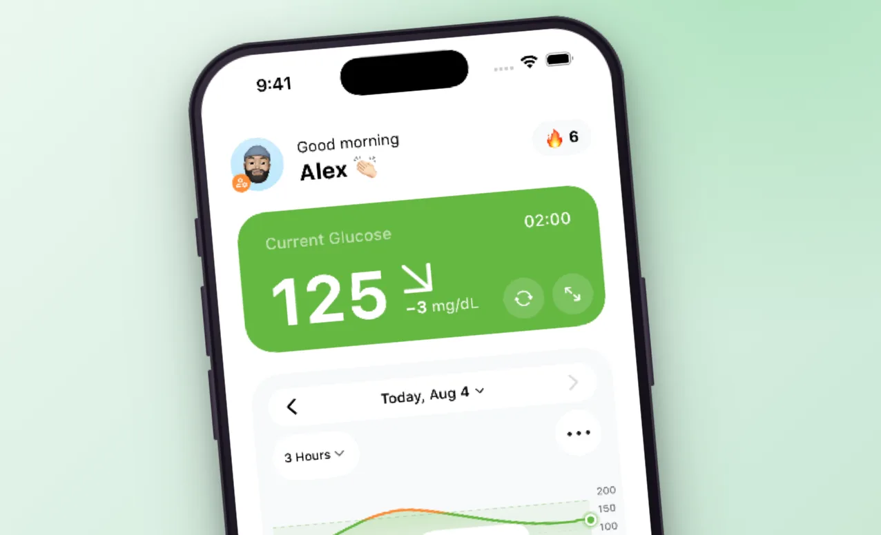 Sugar Sense Home screen with live glucose, trend graph and Time in Range