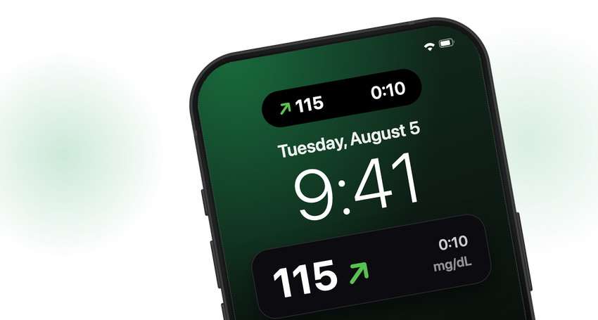 Dynamic Lock Setup Guide Sugar Sense: CGM App with Libre, Dexcom & Nightscout Alerts