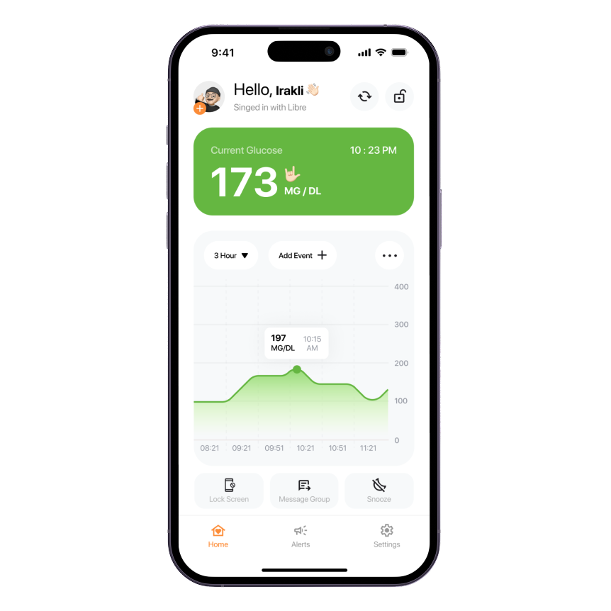 Sugar Sense glucose app on iPhone