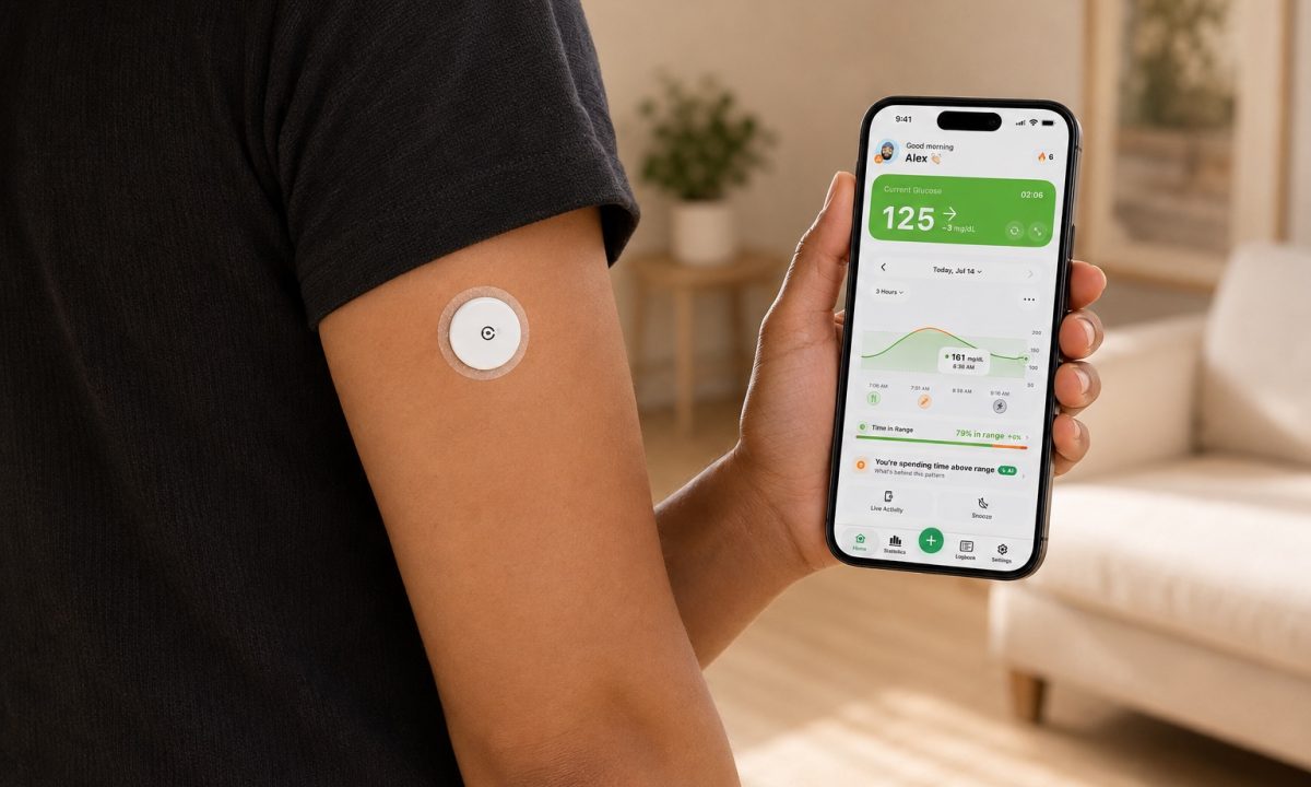 CGM sensor on the back of an upper arm with the Sugar Sense app showing the current glucose reading